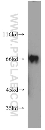 RNF168 Antibody in Western Blot (WB)