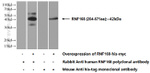 RNF168 Antibody in Western Blot (WB)