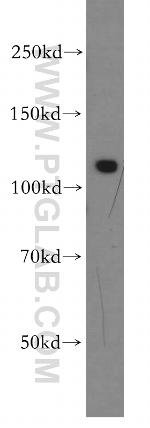 SGSM1 Antibody in Western Blot (WB)