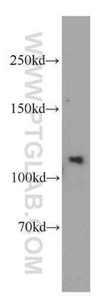 SGSM1 Antibody in Western Blot (WB)