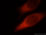 SPATA13 Antibody in Immunocytochemistry (ICC/IF)