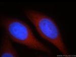 SPATA13 Antibody in Immunocytochemistry (ICC/IF)