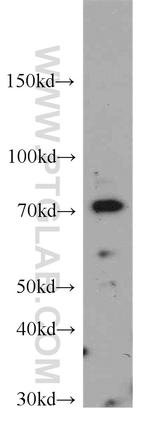 SPATA13 Antibody in Western Blot (WB)