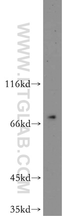 SPATA13 Antibody in Western Blot (WB)