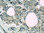 PAK1 Antibody in Immunohistochemistry (Paraffin) (IHC (P))