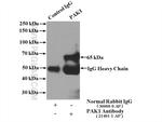 PAK1 Antibody in Immunoprecipitation (IP)