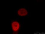 UHRF1 Antibody in Immunocytochemistry (ICC/IF)