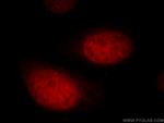 UHRF1 Antibody in Immunocytochemistry (ICC/IF)