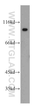 UHRF1 Antibody in Western Blot (WB)