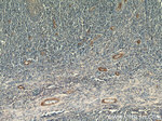 SMMHC Antibody in Immunohistochemistry (Paraffin) (IHC (P))