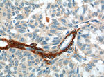 SMMHC Antibody in Immunohistochemistry (Paraffin) (IHC (P))