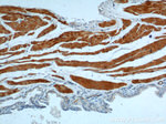 SMMHC Antibody in Immunohistochemistry (Paraffin) (IHC (P))