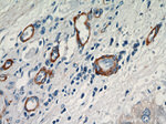 SMMHC Antibody in Immunohistochemistry (Paraffin) (IHC (P))