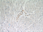 SMMHC Antibody in Immunohistochemistry (Paraffin) (IHC (P))