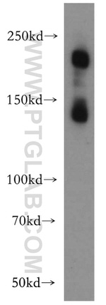 SMMHC Antibody in Western Blot (WB)