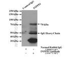 INPP5J Antibody in Immunoprecipitation (IP)