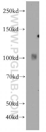 INPP5J Antibody in Western Blot (WB)
