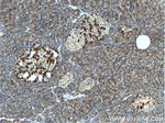 CHIT1 Antibody in Immunohistochemistry (Paraffin) (IHC (P))