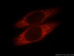 SLC5A8 Antibody in Immunocytochemistry (ICC/IF)