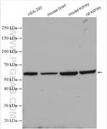 SLC5A8 Antibody in Western Blot (WB)