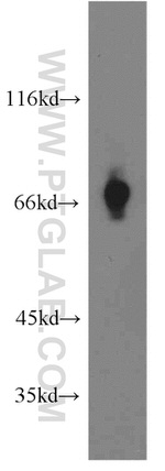 SLC5A8 Antibody in Western Blot (WB)