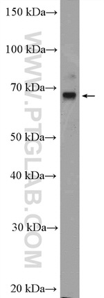 SLC5A8 Antibody in Western Blot (WB)