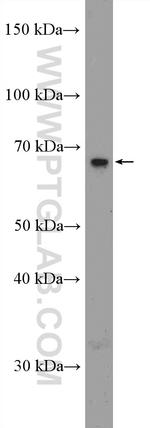 SLC5A8 Antibody in Western Blot (WB)