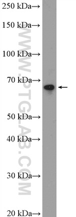 SLC5A8 Antibody in Western Blot (WB)