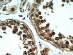 Rubicon Antibody in Immunohistochemistry (Paraffin) (IHC (P))