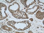 Rubicon Antibody in Immunohistochemistry (Paraffin) (IHC (P))