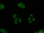 TOR1AIP1 Antibody in Immunocytochemistry (ICC/IF)