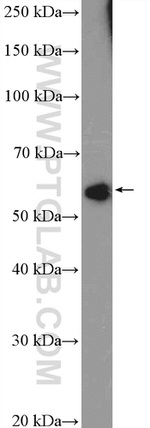 ZNF232 Antibody in Western Blot (WB)