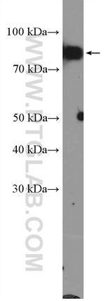 XRCC1 Antibody in Western Blot (WB)