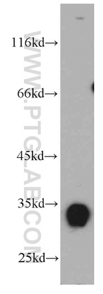 KIAA0513 Antibody in Western Blot (WB)