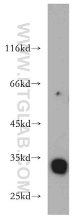 KIAA0513 Antibody in Western Blot (WB)