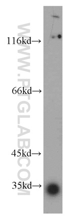 KIAA0513 Antibody in Western Blot (WB)