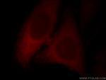 SYNPO2L Antibody in Immunocytochemistry (ICC/IF)