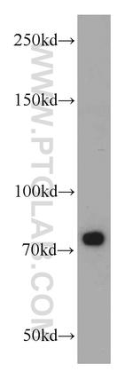 SYNPO2L Antibody in Western Blot (WB)