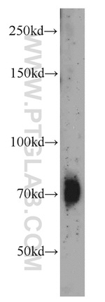 SYNPO2L Antibody in Western Blot (WB)