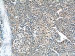 F9 Antibody in Immunohistochemistry (Paraffin) (IHC (P))