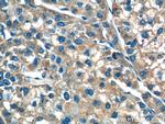 F9 Antibody in Immunohistochemistry (Paraffin) (IHC (P))