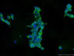 IFIT1L Antibody in Immunocytochemistry (ICC/IF)