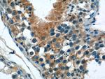 IFIT1L Antibody in Immunohistochemistry (Paraffin) (IHC (P))