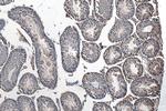 IFIT1L Antibody in Immunohistochemistry (Paraffin) (IHC (P))