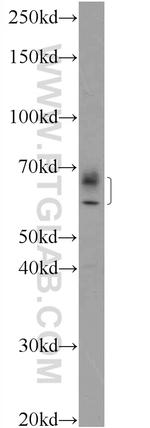 IFIT1L Antibody in Western Blot (WB)