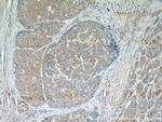 MAGEC3 Antibody in Immunohistochemistry (Paraffin) (IHC (P))