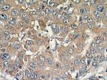 MAGEC3 Antibody in Immunohistochemistry (Paraffin) (IHC (P))