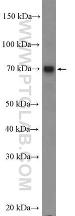 MAGEC3 Antibody in Western Blot (WB)