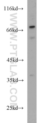 MAGEC3 Antibody in Western Blot (WB)