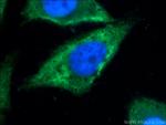 TXNDC16 Antibody in Immunocytochemistry (ICC/IF)